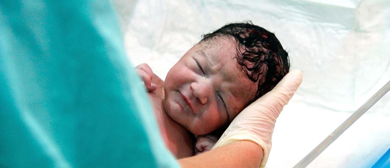Blackmores elective labour induction is it really necessary