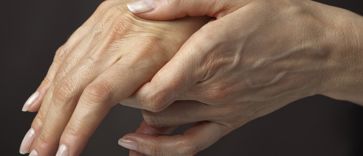 Blackmores arthritis the facts